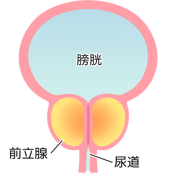 前立腺肥大症とは